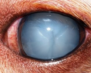 cataracte avant chirurgie